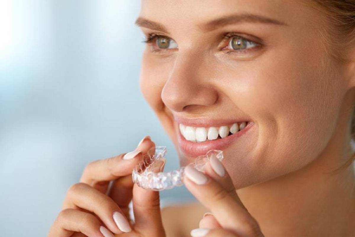 Best Teeth Whitening Products – 10 Best Teeth Whitening Products to Choose.