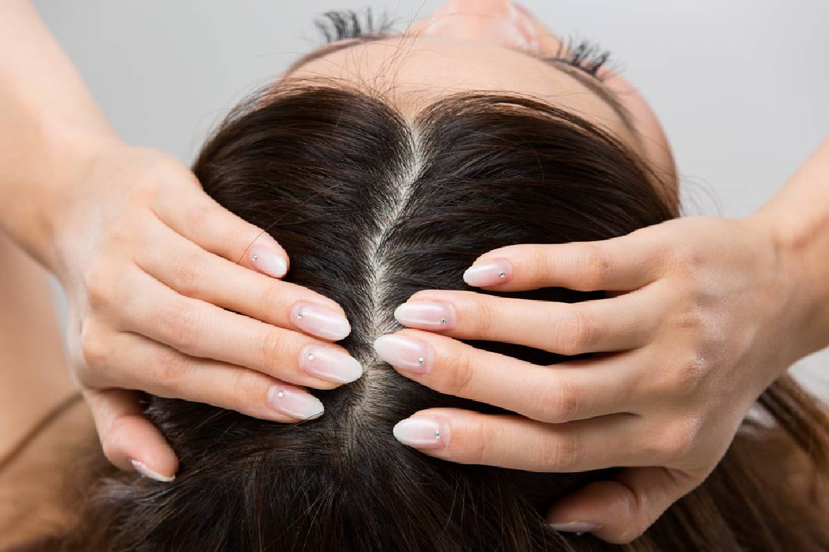 Painful Pimples On Scalp Causes Treatment And Prevent - vrogue.co