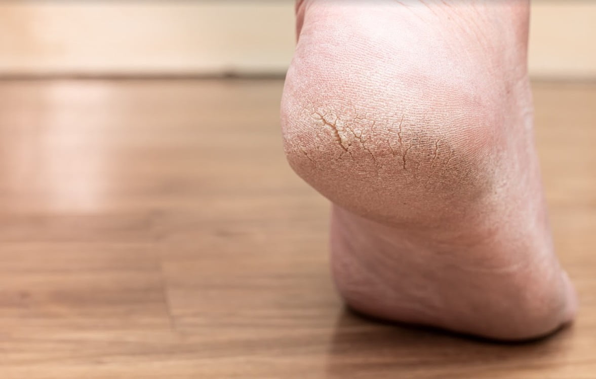 Foot Problems And How To Manage Them