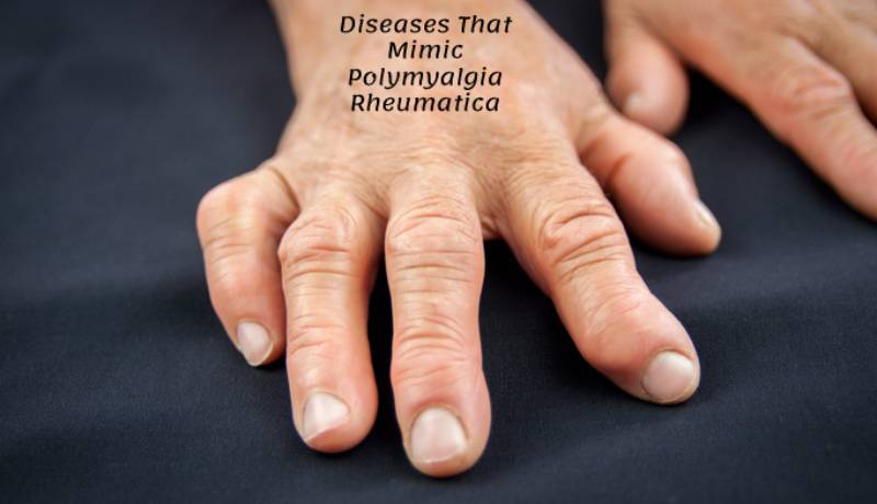 Diseases That Mimic Polymyalgia Rheumatica 
