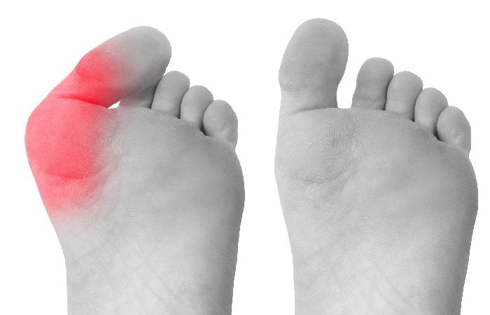 When Is Corrective Foot Surgery Necessary