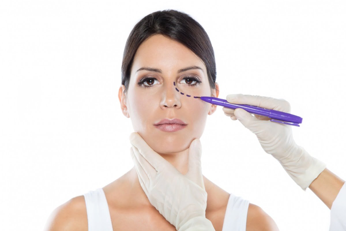 How to Recover Safely After a Double Eyelid Surgery?