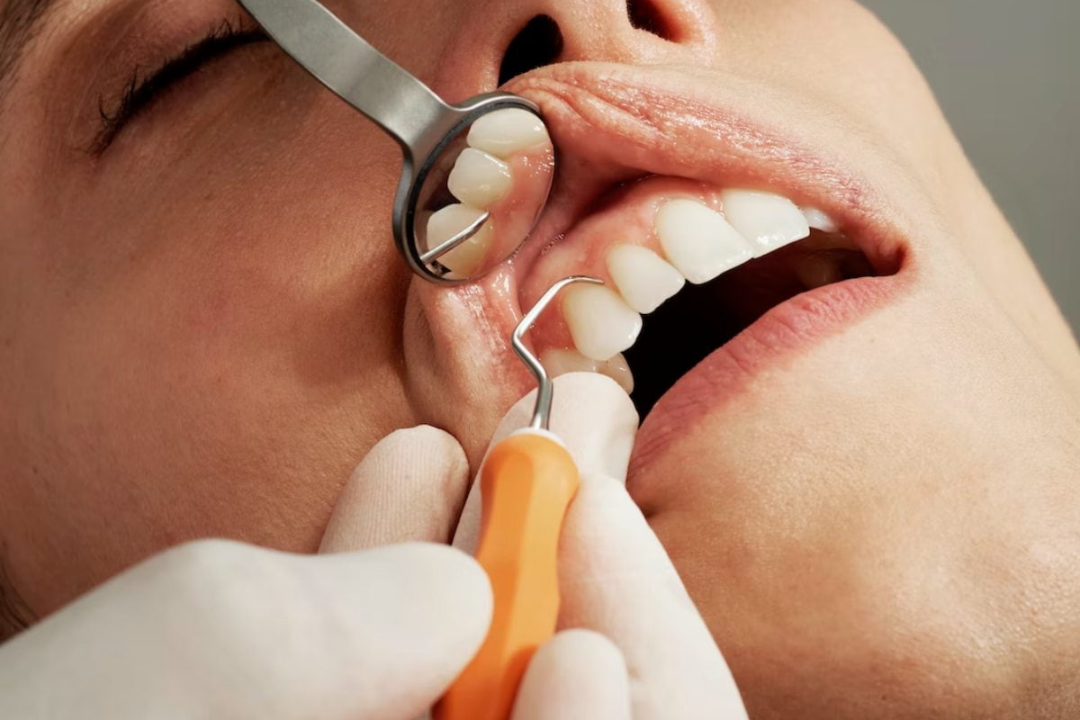 How Often Should I get a Dental Cleaning?