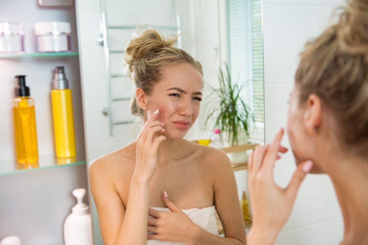 How To Combat Teen Acne The Right Way