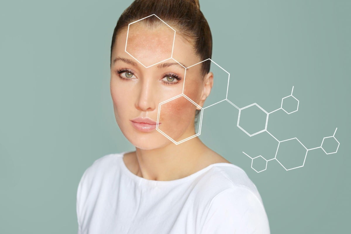 Signs You Have Sun Damage