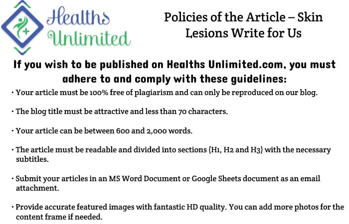 Policies of the Article – Skin Lesions Write for Us