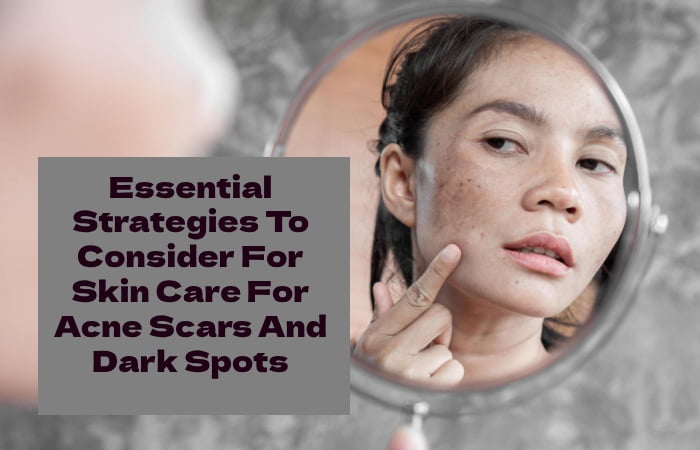 Essential Strategies To Consider For Skin Care For Acne Scars And Dark Spots